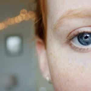 Photo "Can I Really Get Rid of Dark Circles Under My Eyes with Eye Creams?"
